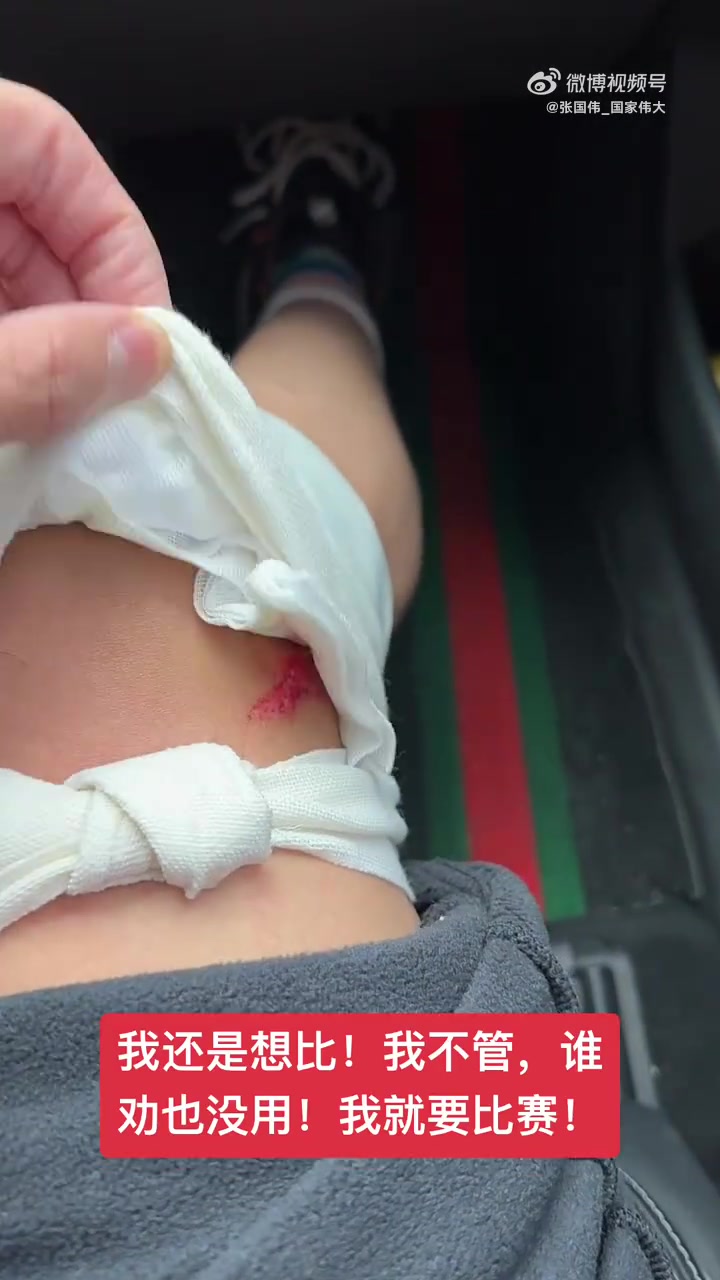 png电子官网张国伟晒受伤视频：我不管，我就要现在比赛，死也死在比赛场上